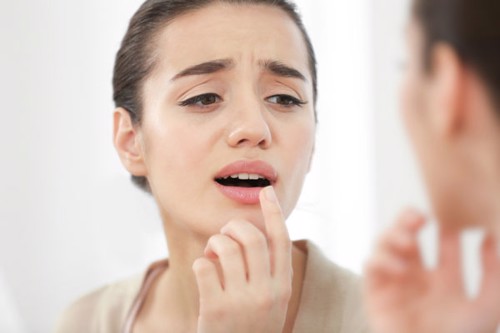 9 cách chữa nhiệt miệng tại nhà không thể bỏ qua